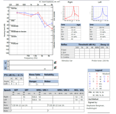 Audiogram Sample